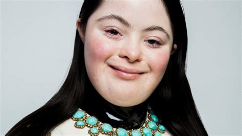 gucci autistic model|Gucci models with disability.